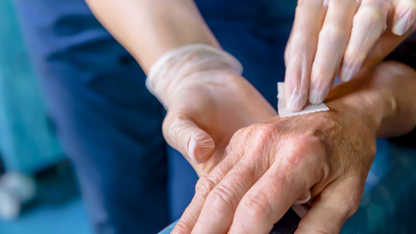 A gloved hand holds a patient's hand and wipes it with an alcohol swab